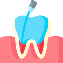 Root Canal Treatment